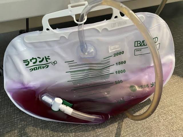 gogo_nurse_nono's tweet photo. これみて
「オシャレな色ですね〜」
っ言ってた研修医
芸術肌すぎる https://t.co/DQ3Jy3b43z