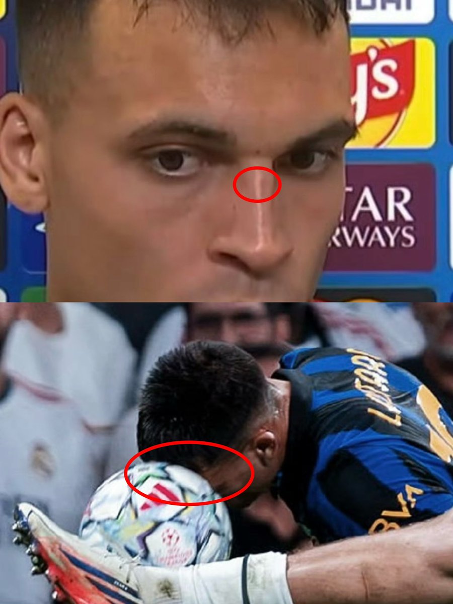 HolidayHK's tweet photo. @AdriRM33 Lautaro’s head touched the ball first. That Real Madrid clown kicked him on purpose. Lautaro was hurt, yet you’re glorifying this reckless fouler. https://t.co/qb4ZQlfb3B