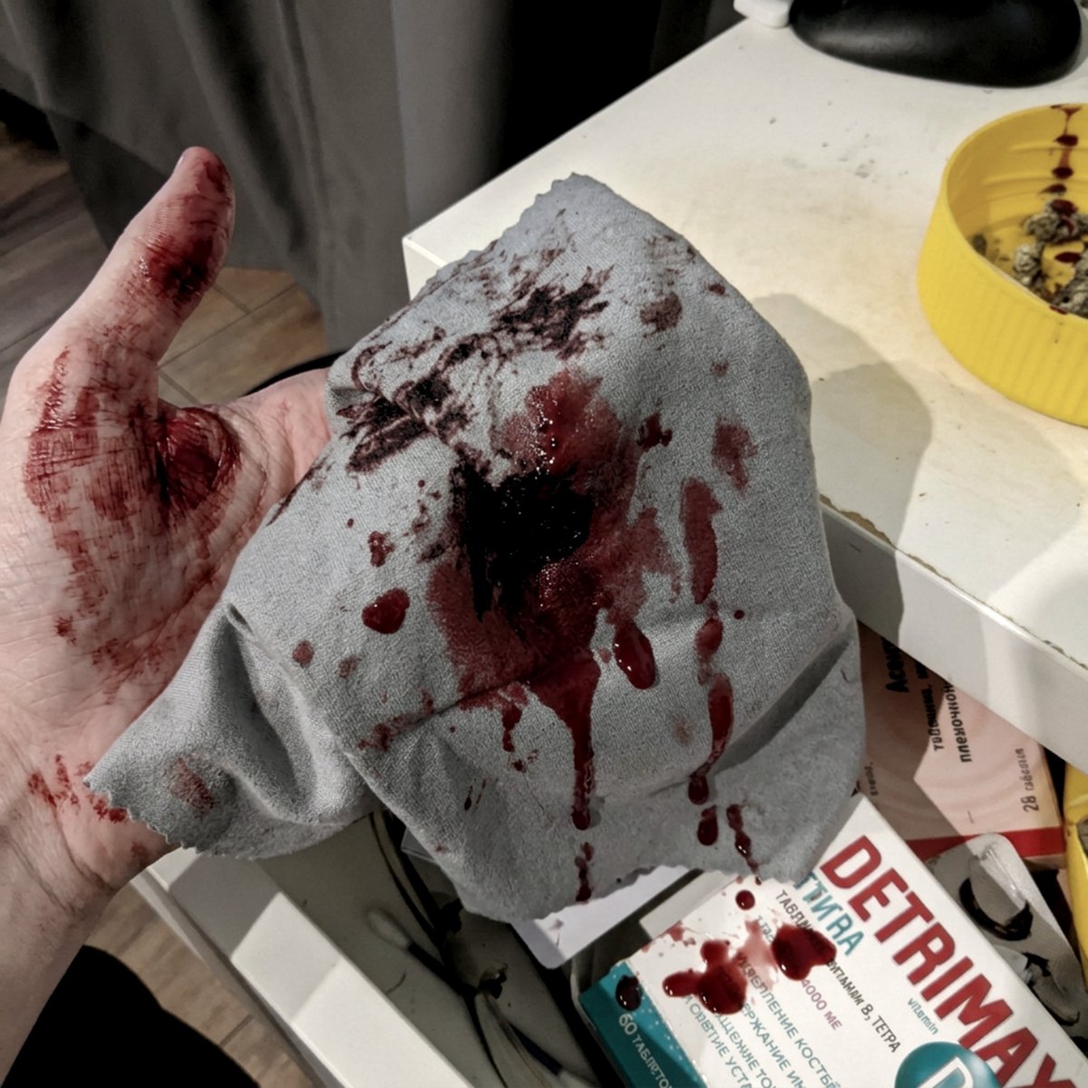 _TrojanAngel's tweet photo. SFX MAKEUP / FAKE BLOOD

#blood #sh https://t.co/NavbBeiJ1c