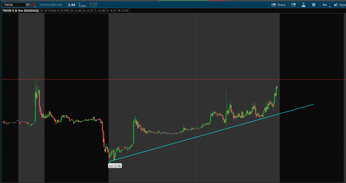 $TNON Tenon Medical Announces Early Repayment of Its Convertible Notes.

Super interesting recovery after the sell-off yesterday after dropping this news.

$3.6
