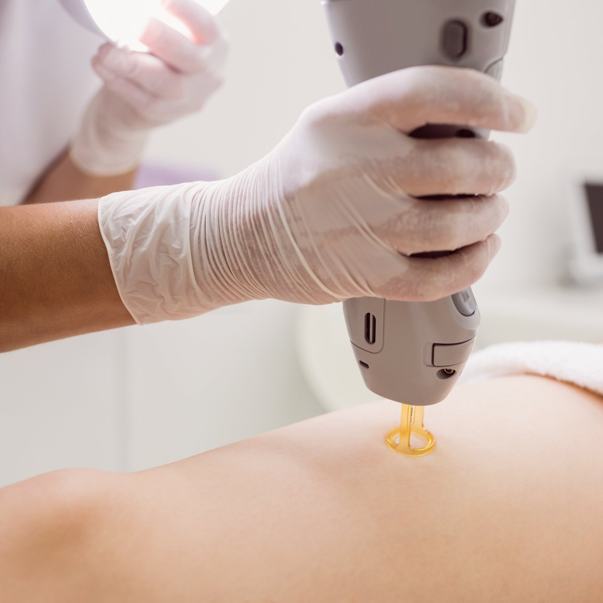 velora_skin's tweet photo. Skin Tag Removal at Velora Skin Clinic (Miami) ✨ Clear skin in a single visit!
• Safe removal with zero scarring
 • Cryotherapy (painless freezing)
 • Electrocautery (instant bleeding control)
 • Laser removal (pinpoint precision)
Book: https://t.co/ZrNHth4Zqg 📅 https://t.co/uUHGj3CY1g
