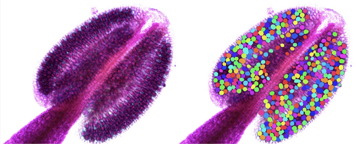 karlriha's tweet photo. No more manual counting of pollen after Alexander staining. AI-base segmentation tool PAT will do it for you faster and with more precision than you. @vivekraxwal @DVolkava   https://t.co/WHpdfcZutW https://t.co/aR9tuAar2h