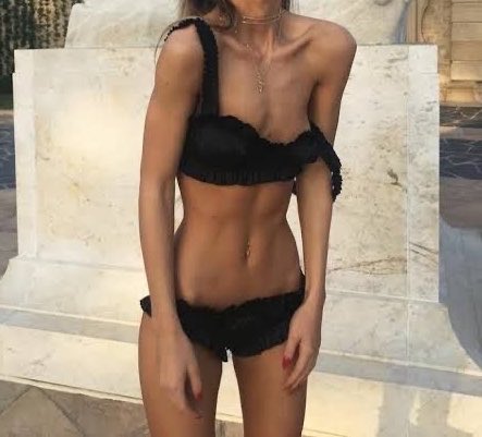 BunnyAngelDol's tweet photo. #thinspo https://t.co/sLoNCkVQQg