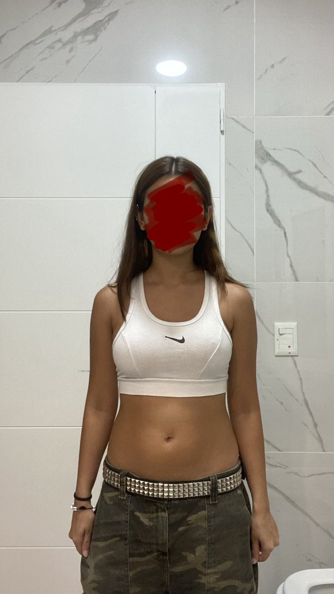 Zuzucreep's tweet photo. 49kg vs 43,2kg
Do yall see a difference from the front cause i only see from difference from the side lowk
Also my side profile looks so much better now
#bc #bodycheck https://t.co/Z81I2ghyUG