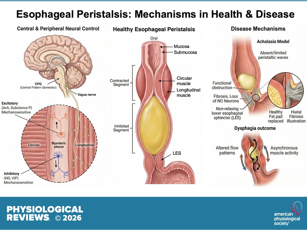 physiolrev's tweet photo. 🆕@physiolrev "Esophageal peristalsis in health and disease: mechanistic insights"
Ravinder K. Mittal et al.
https://t.co/MDsco3Ct01
#EsophagealPeristalsis #MechanosensitiveNeurons https://t.co/ZOcj1UXSvo