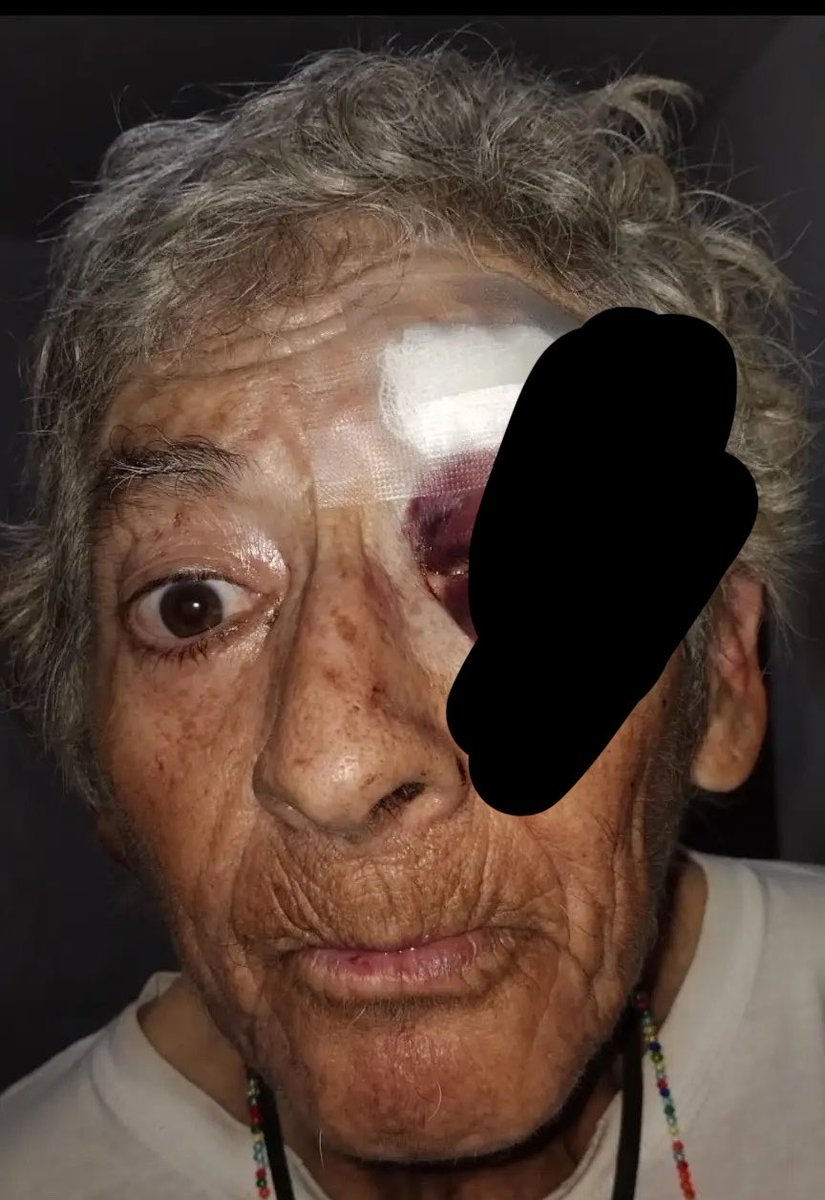 ticnt_'s tweet photo. URGENTE

Ministerio, medios, donaciones LO QUE SEA

Un joven tiene a su madre anciana con problemas psiquiátricos. Se hace daño todo el tiempo y la acaban de botar de su alquiler. Ha buscado ayuda hasta en la municipalidad (los olivos) y nada:(

Donaciones o ayuda: +51 946585807 https://t.co/OwM0Lfdwfp
