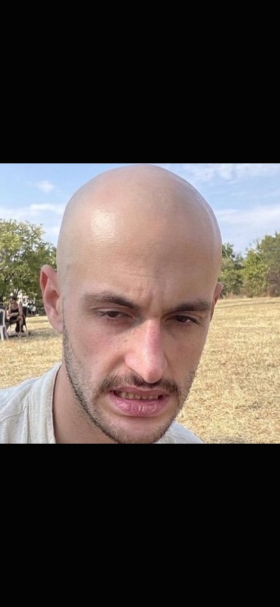 LuffyDMonkeyfan's tweet photo. @yungreal69 Yung if you don’t pick me this time🫰 I’m gonna make you completely bald🧑‍🦲 #BaldYung ‼️
8bQyQ1CiDGktEjj8bVouY8B1PnepGbua1vF1Gw2fw7dx https://t.co/h8RlcVrtgp
