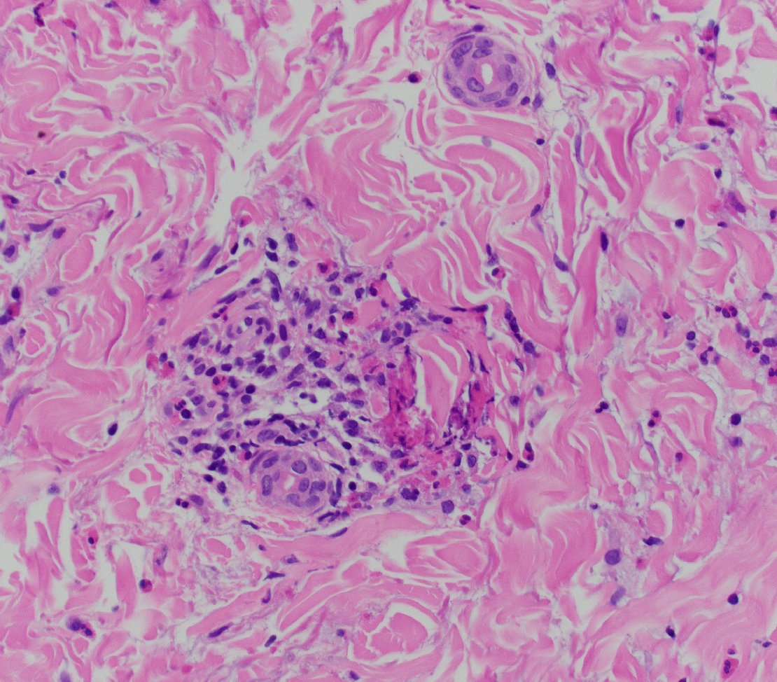 CakePath's tweet photo. 🔥🔬 Hello, Dermpath world! Would you buy these as flame figures? 👀
#pathology #pathologists #pathTwitter #dermpath #dermatology #dermtwitter https://t.co/0jfFNYMAGt