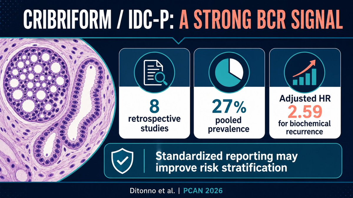 pcan_journal's tweet photo. Cribriform pattern and intraductal carcinoma predicted biochemical recurrence after radical prostatectomy (adjusted HR 2.59) in this meta-analysis. Standardized reporting may strengthen postoperative risk stratification. 

🔗[https://t.co/voTVaJSihq] #ProstateCancer #Pathology https://t.co/TsN2InDTIq