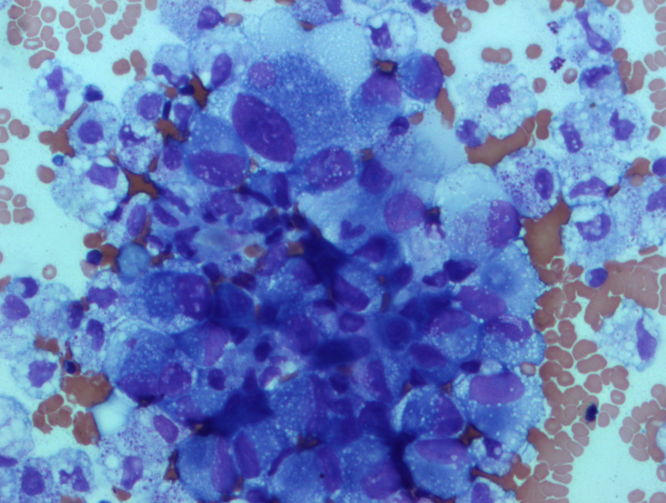 KarrsJeremiah's tweet photo. dont see that every day #cytology https://t.co/MjRPDAM2cX