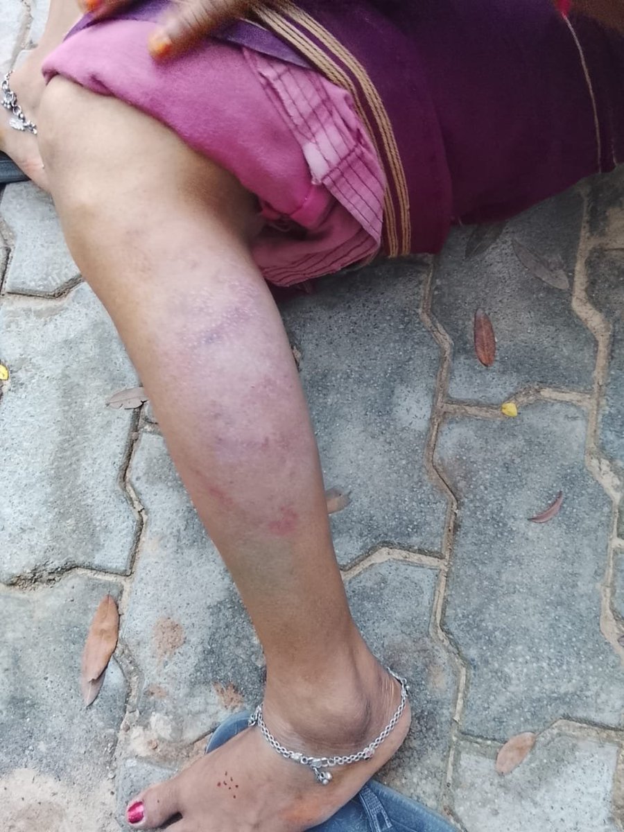 ManishCEO2's tweet photo. यूपी के सीतापुर के थाना तंबौर एसएचओ ब्रजेश रॉय द्वारा दलित महिला को बंधक बनाकर पीटने का आरोप लगा जो लोकतंत्र की हत्या करना है। पहले पीड़िता की तहरीर के आधार पर एसएचओ पर मुकदमा दर्ज कर विवेचना करें और सख़्त कार्रवाई हो। महिला को न्याय मिले। @Uppolice https://t.co/qylEi4EVDX