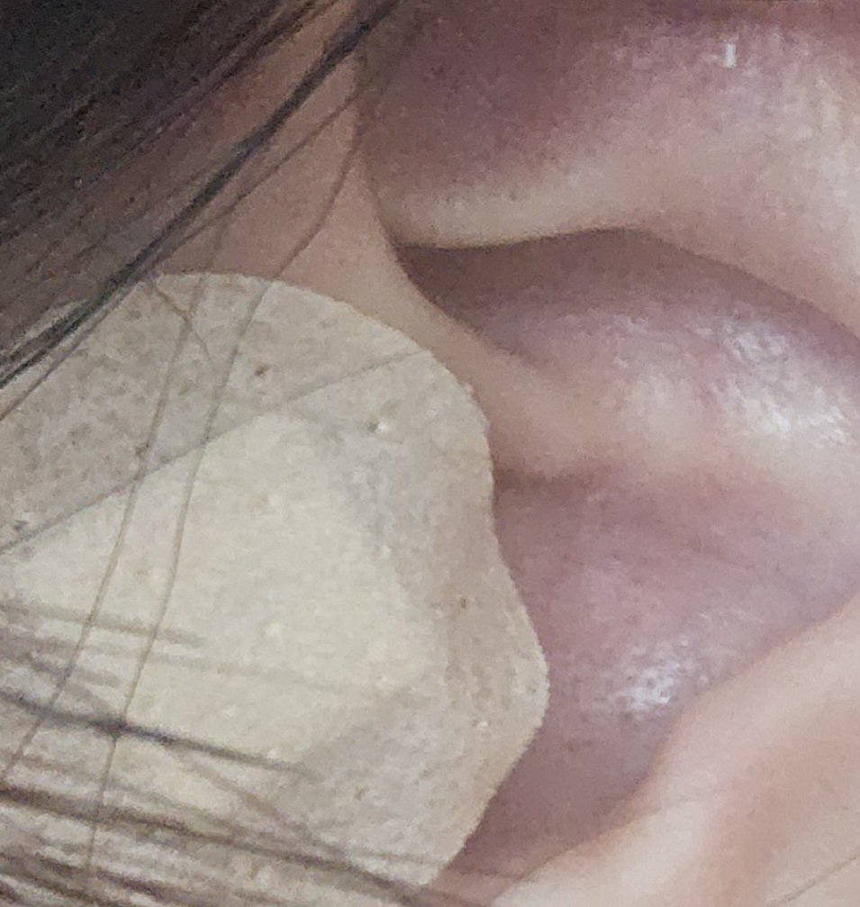 UtadaZoey's tweet photo. I won't be streaming tomorrow... After 1 shot next to my ear and 3 shots on my neck, I've been in a lot of pain. I'm resting my jaw right now. Sorry😩😩 https://t.co/bFWNqASw13