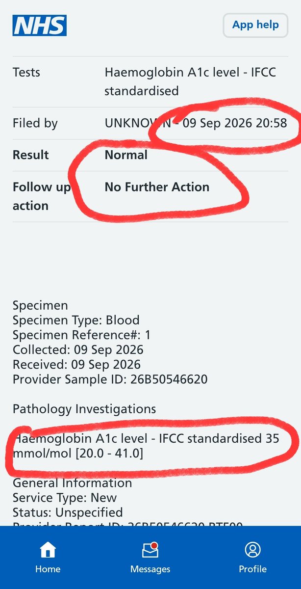 lowcarb_tim's tweet photo. 21st May started #LowCarbDiet 

9th Sept #Type2Diabetes reversed / in remission / cured. Not bothered how you phrase it, it is possible. And to be honest it's really not that difficult. 

A @lowcarbGP video kick-started it, many others assisted the journey. Thank you all 🙏👍 https://t.co/34ciTWuvin