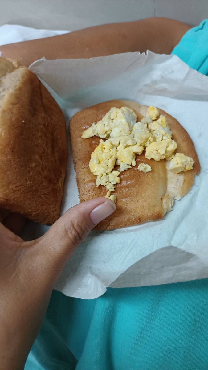 GARCIPAVON's tweet photo. Testimonio de un derechohabiente del IMSS 👇

¡Hola a todos! Solo quería presentarme y compartir una foto que tomé, 48 horas que no le daban comida a mi familiar, sin indicaciones del médico de ayuno, simplemente el de la comida finalmente comentó que la traía en otra lista. Afortunadamente, pude ingresar comida de contrabando, pero se ponen muy severos para que no te despegues del lugar, y finalmente le dieron esto. No puedo referirme mal aunque quisiera porque es comida, pero es una burla. Tengo 2 años de no darle harina por indicación médica y salen con esto! Clínica 17 en Monterrey, la cama de los años 60 no funciona para posicionarse, el problema es en la pierna y debe tenerla levantada para desalojar líquidos, pero está hacia abajo. Te quejas y solo se limitan a decir: "Es lo que hay". No se vale que digan "contrata un seguro particular", no cuando tienes 42 años aportando y no cualquier cantidad, es un derecho, no es limosna, pero este es nuestro sistema de salud tipo Dinamarca según nuestros gobernantes.

✍️   Tom Rey