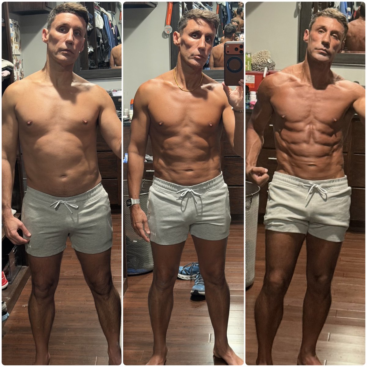 DegenDocMD's tweet photo. Just turned 52.

DEXA doesn’t care about my feelings.

June 2025:
22.4% body fat.
Hired a trainer.
Lifted hard.

8 months later (Feb 2026):
still 22.4%.
+2.2 lbs lean mass.
That’s all training bought me.

Then the stack started:
March — Retatrutide + CJC-1295/Ipamorelin
May — TRT
June — FLGR-242

Last 8 weeks (June 25 → Aug 25 DEXA):
+8.78 lbs lean
–1.51 lbs fat
While still on Reta.

Feb → now:
22.4% → 13.1% body fat
+14 lbs lean
–14.6 lbs fat

I was skeptical.
Multiple variables.
N=1.

But the lean-mass acceleration only showed up after FLGR-242.

Gaining ~1 lb of verified muscle per week on a GLP-1 is not a normal outcome.

@JayCampbell333 — credit where it’s due.

@BiohackerJake @n1after40 @NocturnalNelly @BalLongevity @GuerillaCh3mist @MattDChrist