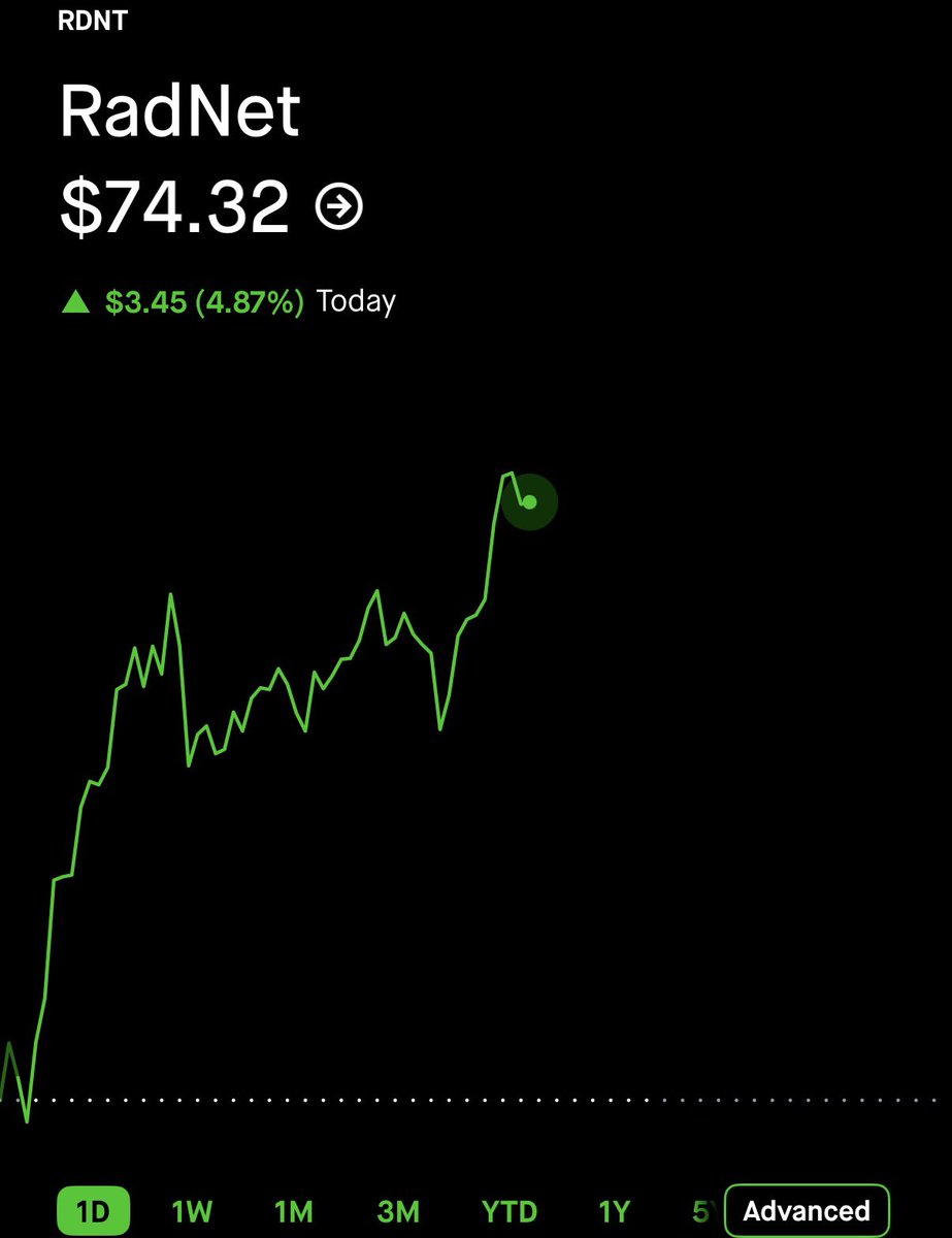 StockOptions___ tweet picture
