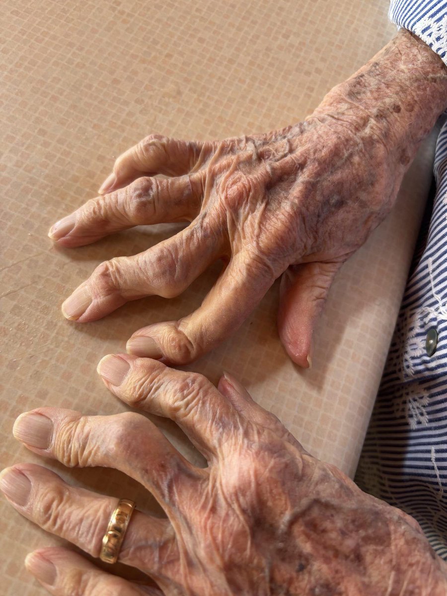 SandyofCthulhu's tweet photo. This is my mother-in-laws hands, after 101 years of service to her family, her friends, and her God. 

She has over 200 descendants. https://t.co/H8uMWeLt0p