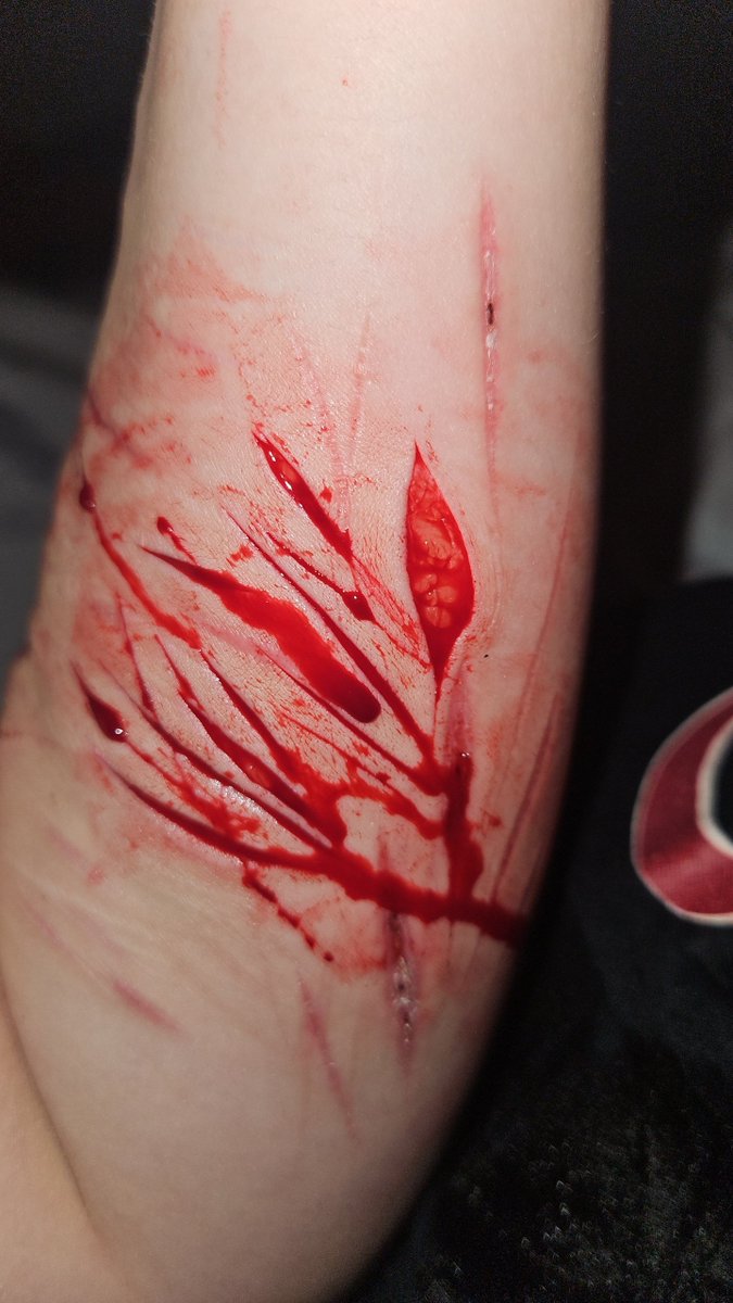 corpse_aliveX9's tweet photo. I hate you so much just leave me alone please
#shtwt #shedtwt #988twt #cuttwt #cutwt

ALL SFX ALL FAKE HALLOWEEN PRACTICE MAKEUP NOT REAL https://t.co/xLdu7x231e