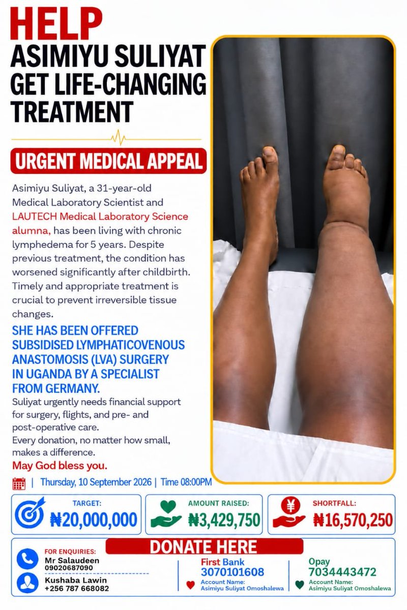 davorigaga's tweet photo. 🚨 SUPPORT SULIYAT’S SURGERY 🚨

Suliyat is living with chronic lymphedema and urgently needs life-changing surgery.

Through your generosity and kindness, we’ve reached 13.60% of our ₦20 million target. 🤲🏽 We still have 86.40% to go. https://t.co/fh2HYjvgey