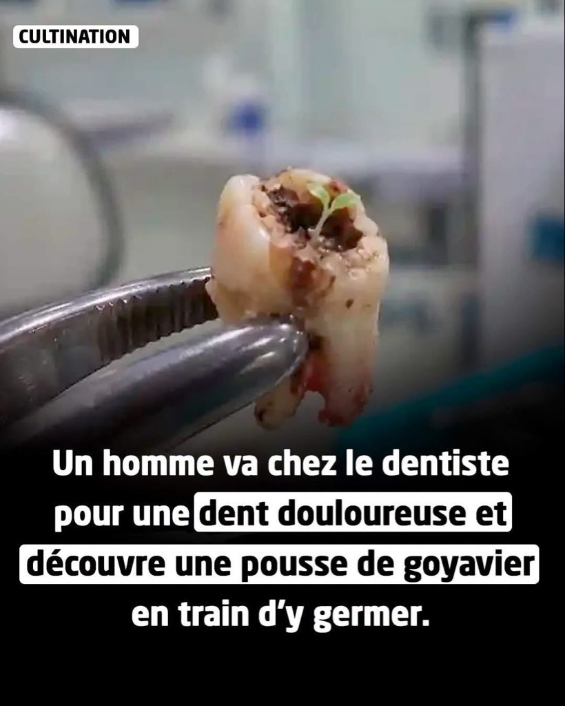 HamidAli230's tweet photo. Quand j'étais petit, on me disait que si j'avale les graines de goyavier, ça va pousser dans mon ventre, donc l'affaire là c'est vrai ?.🥺🥺 https://t.co/9ld1qwV4X7
