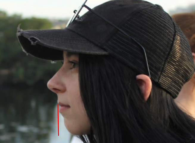morvfv's tweet photo. @ToontownHacks @sphinxpantera @DomainDead @Clavicular0 ''its not recessed its just not elongated artifically like mcdonald moonman'' ahaha yeah ok keep coping

listen idgaf if you're recessed or not and if u get any surgeries or not, but you need to stop being delusional and not 1 above avg guy is finding you attractive

nothing else https://t.co/5jC0AOpaAC