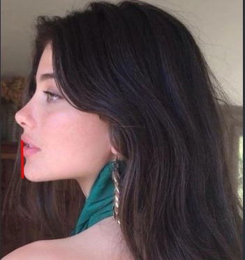 morvfv's tweet photo. @ToontownHacks @sphinxpantera @DomainDead @Clavicular0 ''its not recessed its just not elongated artifically like mcdonald moonman'' ahaha yeah ok keep coping

listen idgaf if you're recessed or not and if u get any surgeries or not, but you need to stop being delusional and not 1 above avg guy is finding you attractive

nothing else https://t.co/5jC0AOpaAC