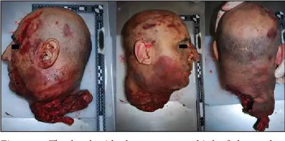 SneakyGreely's tweet photo. #goretwt #g0retwt #g0r3twt 

- Educational photos made with ai, sfx and makeup

⚠️No real person was harmed in these photos https://t.co/Y53OcLYFLR