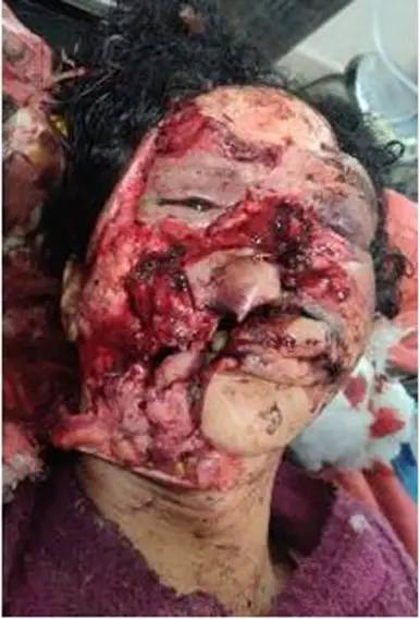 SneakyGreely's tweet photo. #goretwt #g0retwt #g0r3twt 

- Educational photos made with ai, sfx and makeup

⚠️No real person was harmed in these photos https://t.co/Y53OcLYFLR