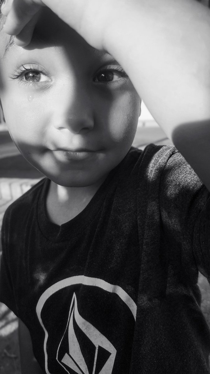slightlyrobotic's tweet photo. [ The Beauty Of A 'Boo-Boo' ]

#fineartphotography
#portraiture 
#candidphotography 
#blackandwhitephotography
#storytelling https://t.co/I0NKXg79YR