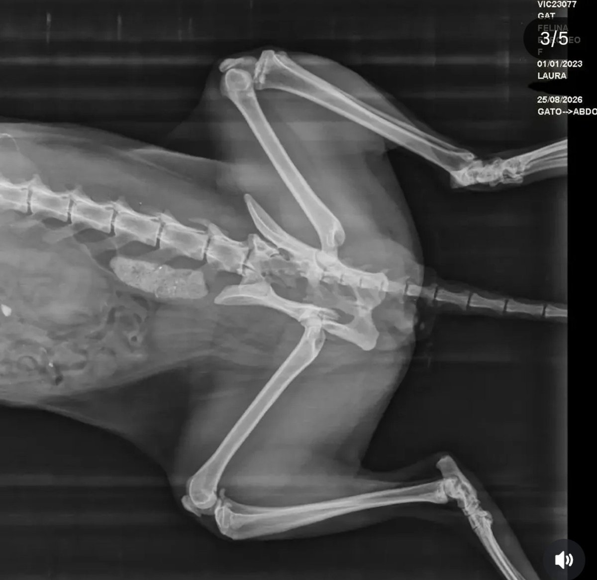 Neinei_rescue's tweet photo. Hola, chicos.
Traigo un vaso externo grave 😣😣😣 Me podéis leer?

Atropellaron a un gatito y, lo de siempre, no se pararon. Nadie se paró. Pero pasó una chica que no miró a otro lado.

Tiene fracturada la pelvis y es muy probable que haya que amputarle la cola. De momento están intentando salvarsela y solo por la atención en urgencias y las pruebas ya han pagado casi 600€. Y calculan mínimo otros 500€ en curas y visitas. Será más si hay que amputar.

La chica que lo encontró es estudiante.
Evidentemente que esto lo hacemos por los gatos. Pero echarle una pata a alguien tan joven que ya se está preocupando es, a parte de darle las gracias, animar a más gente a no mirar a otro lado.

Si podéis donar 1€, 2€, 10, lo que podáis. Se que llega la cuesta de septiembre pero con lo que te cuesta un café ya estás ayudando un montón.

No pongo fotos de la cola porque son muy gráficas pero os pongo la radiografía y una foto del gatito🙏🏻

Están todas las facturas subidas al gofoundme:
https://t.co/BNPP9tPgen