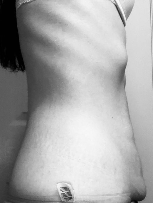si38ejh's tweet photo. Guys what are workouts I could do to flatten my stomach? I really want to get rid of my stomach fat #edrtwt #bc #shedrtwt #ricecaketwt https://t.co/Lrlbr4SHM5