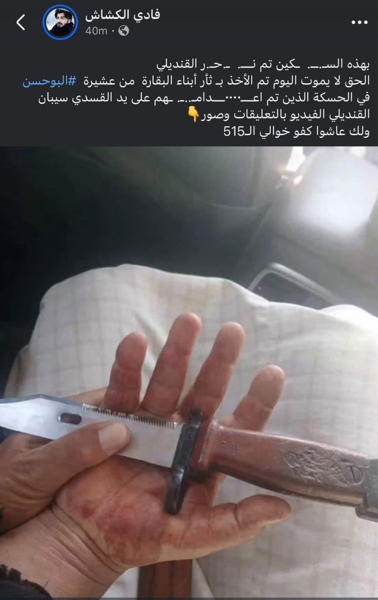 Kurdetay's tweet photo. This is the reality of Syria’s new government under Ahmed al-Sharaa #Jolani polished suits, carefully chosen words, and promises of a new #Syria on the surface—while #violence against minorities continues beneath it. https://t.co/k7sgLfCzz5