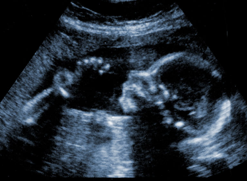donotelia7388's tweet photo. Saying personhood is dependent on subjective experience is like saying personhood is dependent on skin color; it's arbitrary and stupid. https://t.co/DNfIvyFmgI