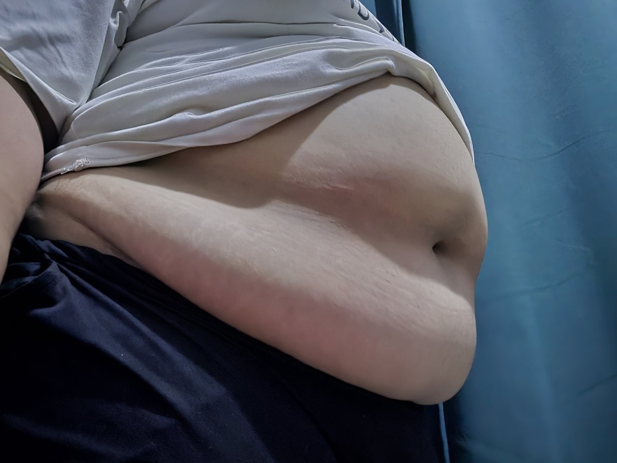 polipop96's tweet photo. Inicio esta cuenta con mi pancita. 

Algo que ig, no aceptarán. 

#feedeegirl #stuffingbelly #fatgirlbelly #weightgain https://t.co/yaFOIe2xSz
