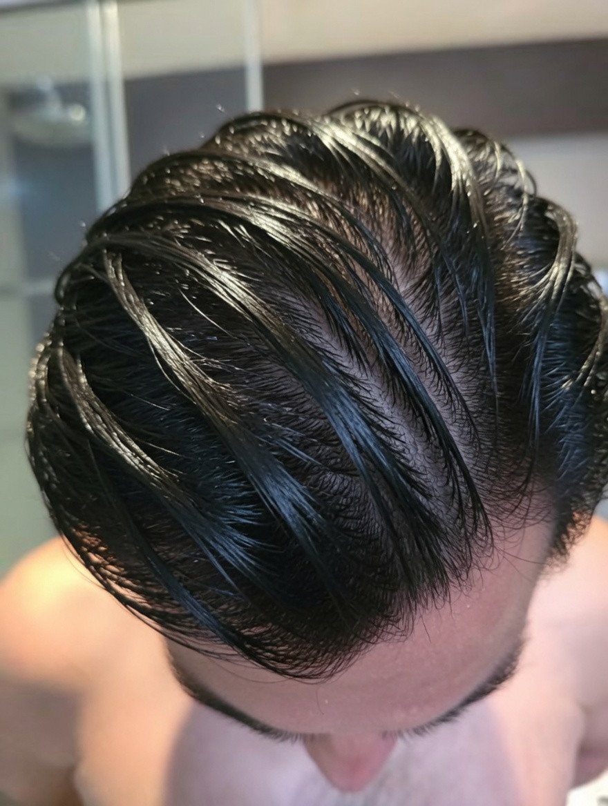 MagnusLindbrg's tweet photo. Harvard scientists now know how to grow hair back.

By age 35, 2 out of 3 men lose their hair (regardless of genetics).

Here are 7 ways to grow yours back (&amp; keep it dark):

1. Your follicles do not die when the hair goes https://t.co/rRxMJLogTL