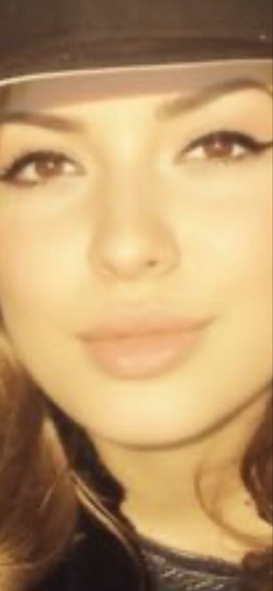 SparkyLaBraina's tweet photo. @belle_epoque86 @FBIDirectorKash Keep adding Botox to those lips and they may hide your eyes altogether. https://t.co/4EpKSGw88v