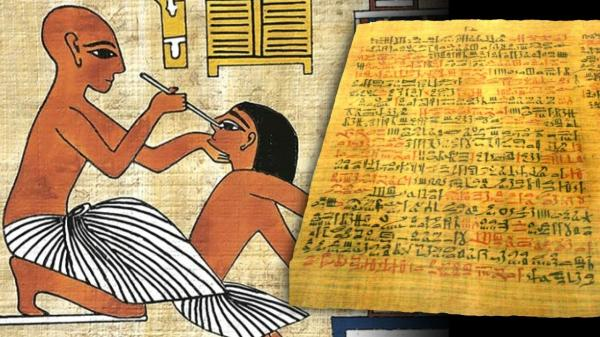MillieMarconnni's tweet photo. A 3,500 year old Egyptian medical scroll prescribed honey for open wounds. Hospitals are stocking the same thing in sterile packets right now.

The scroll is called the Ebers Papyrus, and it's one of the oldest medical documents on Earth.

Egyptian doctors were using honey as a wound dressing around 1550 BC. Doctors in ancient Sumer were writing it into prescriptions even earlier, around 2100 BC. Aristotle later wrote about using it on sore eyes. Then antibiotics showed up in the 1940s, honey got filed under old folk remedy, and it sat there ignored for half a century while modern medicine assumed the ancients had just gotten lucky.

One man spent thirty years proving they hadn't.

His name was Peter Molan.

He taught biochemistry at the University of Waikato in New Zealand and spent most of his career studying antibacterial compounds that had nothing to do with food.

Then in 1981, a beekeeping friend kept telling him to take a closer look at manuka honey, made from the nectar of a scraggly little tree that grows wild across the country. Maori communities had been putting it on cuts and burns for generations.

Molan was skeptical. Honey was something you put in tea, not something you put on a wound.

He ran the tests anyway.

Ordinary honey kills bacteria two ways. The first is almost embarrassingly simple. Honey is nearly pure sugar with very little water in it, so when you put it on a wound, it pulls water straight out of every bacterial cell nearby. The bacteria dry out and die. The second mechanism comes from the bees themselves.

While they make the honey, they add an enzyme called glucose oxidase, which slowly leaks out tiny amounts of hydrogen peroxide, the same stuff sitting in a brown bottle in your medicine cabinet.

That part was already known before Molan started.

What he found was stranger. When he neutralized the hydrogen peroxide in manuka honey, the antibacterial activity didn't go away. Something else in it was doing the killing, and it wasn't fragile the way peroxide is. It didn't break down under heat or light.

Molan chased that mystery compound for years and never fully nailed it down himself. It took until 2006, over two decades after his first experiment, for another team of researchers to isolate it. It's called methylglyoxal, and manuka honey holds far more of it than any ordinary honey does.

Here's the detail that should actually stop you.

Labs have tried for years to grow a strain of bacteria that can survive manuka honey. With antibiotics, resistance is basically inevitable if you wait long enough. The bacteria mutate around one weak point in the drug and the drug stops working.

Nobody has managed to breed a strain resistant to manuka honey. Not MRSA, the staph infection that shrugs off most antibiotics. Not the drug resistant strains of Pseudomonas that make surgeons nervous. The honey doesn't hit one single target the way a drug does. It attacks the whole cell from a dozen directions at once, and there's no single mutation that dodges all of them.

Hospitals noticed.

There's a case from a UK wound clinic that keeps getting cited in the medical literature. An 80 year old man had a skin graft on his arm that got infected with MRSA and refused to heal for months, even with antibiotics running the whole time.

Doctors switched him to a manuka honey dressing, changed every two to three days. The infection cleared and the wound closed. It's one story among dozens just like it, which is exactly why manuka honey dressings now sit in hospital supply rooms around the world, cleared by the FDA for treating wounds and burns.

Molan spent most of his career being politely dismissed by people who assumed he was studying a kitchen ingredient.

He retired in 2014 and died the following year, having built an entire research unit around a jar of honey a beekeeper once handed him on a whim.

The Egyptians never knew why honey worked. They just knew that it did, and they wrote it down anyway.

It took three and a half thousand years, one stubborn biochemist, and a compound nobody could pronounce to finally prove they were right the whole time.