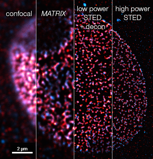 Abberior's tweet photo. Nuclear pore complexes labelled for NUP96🟥 and Mab414🟦, imaged from confocal to high-power STED.

Each imaging mode reveals progressively finer structural details.

One sample, multiple imaging modes - with the #MIRAVAPolyscope.

#fluorescencefriday https://t.co/SIpz2sdlT7