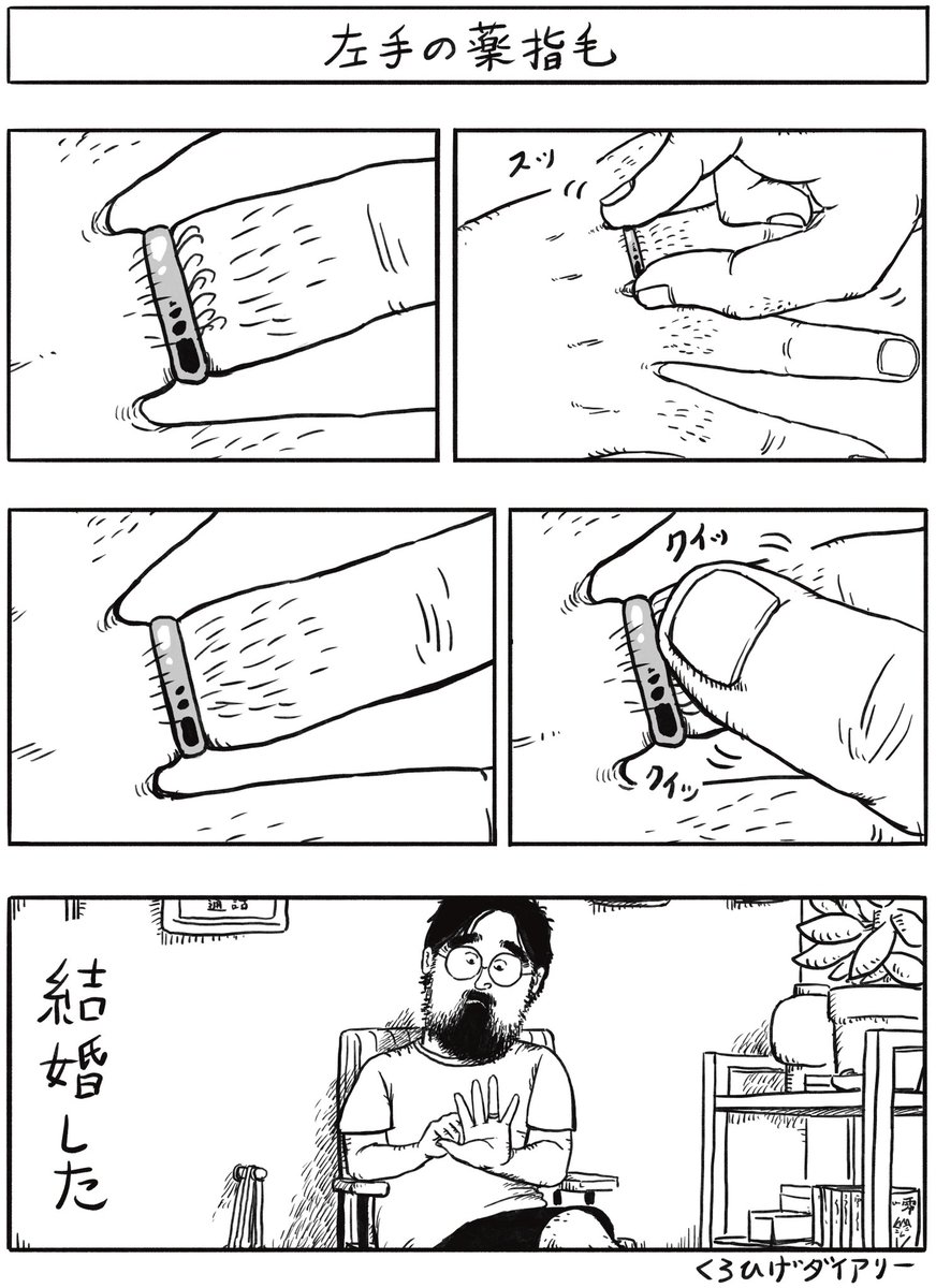 watabehitsuji's tweet photo. 左手の薬指毛 https://t.co/WqliY24z2f