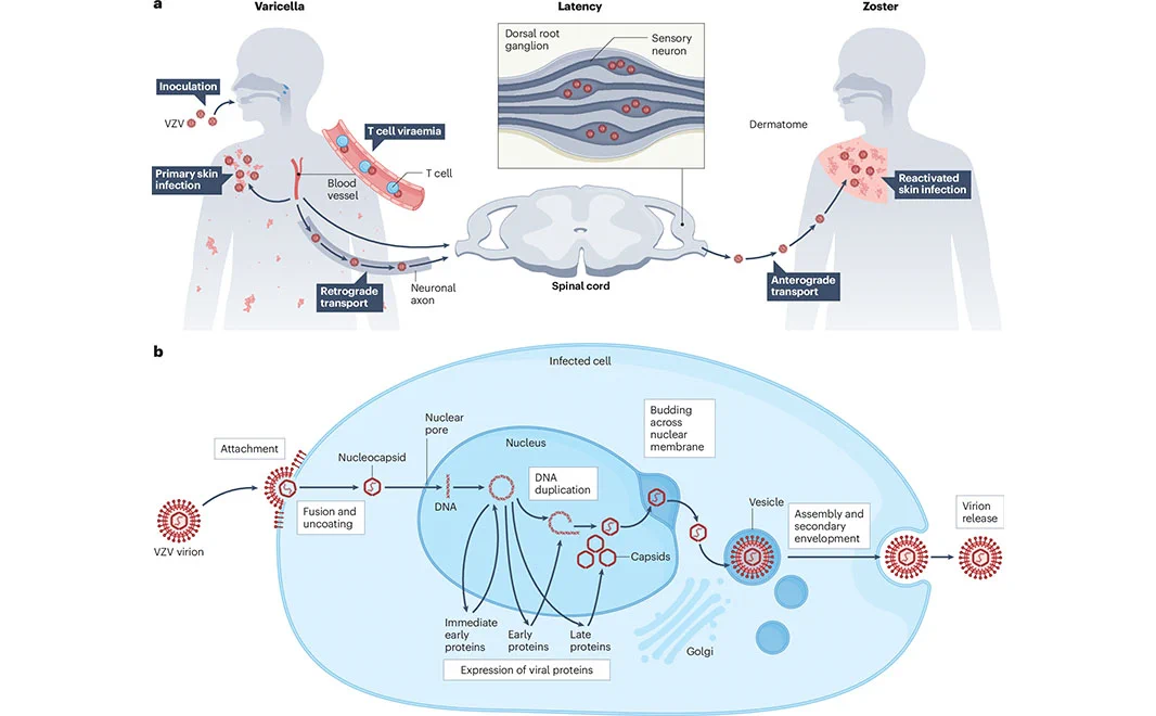 This is figure 1, which shows varicella zoster virus life cycle. 