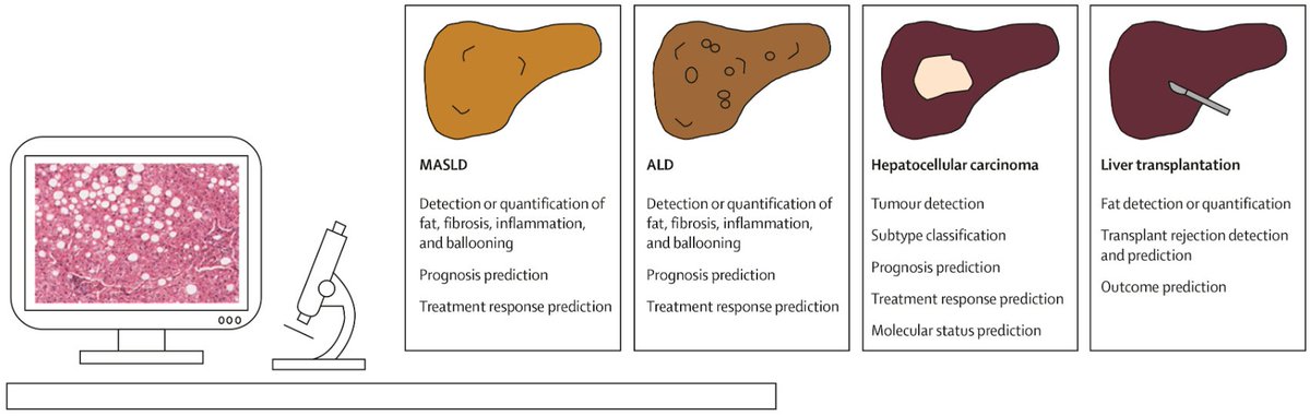 LancetDigitalH's tweet photo. NEW Review: Digital pathology, image analysis, and #ArtificialIntelligence in liver disease.

Read it here: https://t.co/nyp0AQSAgK https://t.co/YGQLYK9Xvs
