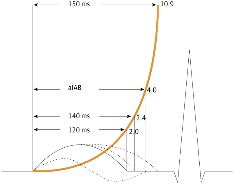 gbiondizoccai's tweet photo. Must-read review on atrial dyssynchrony and Bachmann bundle pacing in the latest issue of JAMA Cardiology https://t.co/SXU4c5au6i @JAMACardio https://t.co/XG8DHmesR5