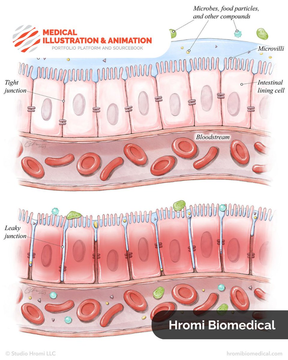 Medillustrates's tweet photo. Hromi Biomedical combines scientific accuracy with an elegant watercolor style in this detailed gastroenterology illustration for Maria Noël Groves' book, Herbal Gut Health.
Explore more: https://t.co/2Qq3xj5504
#medicalillustration #guthealth #leakygut #gastroenterology https://t.co/t0zHFjvyFS