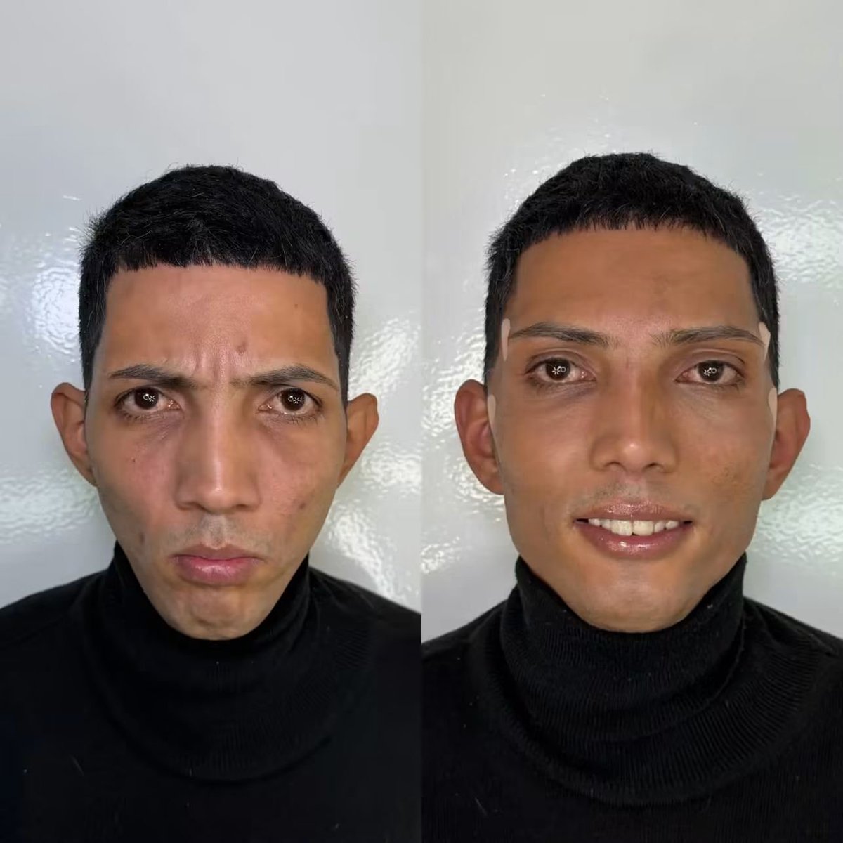 CrisutIV's tweet photo. JAJSJAJAJAJAJJA que mierda se hizo el flaco del vive 100 en la cara https://t.co/pxkZ0lOc6E