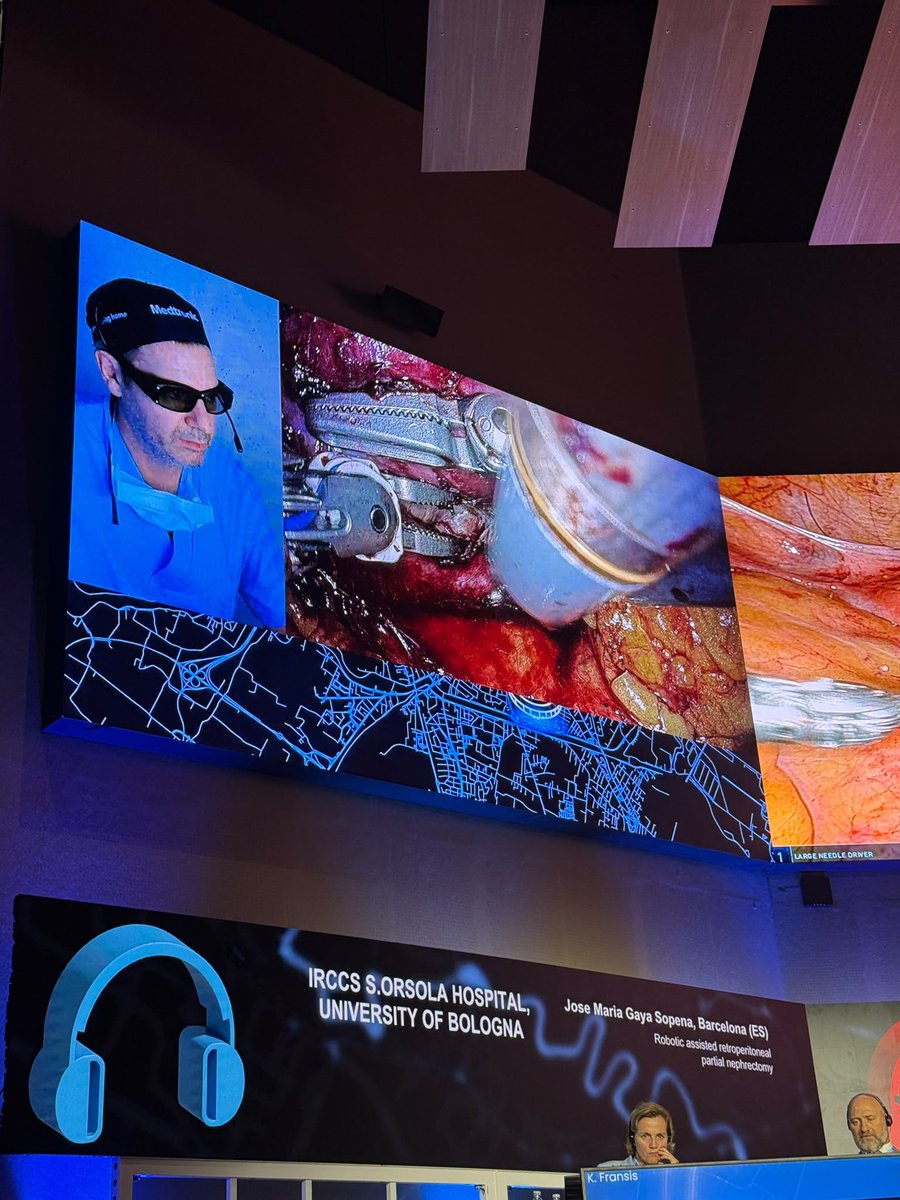 DrJM_Gaya's tweet photo. It was a pleasure to parcipate another year in the @ERUSrobotics doing live surgery (retro partial nephrectomy with HUGO). @FPuigvert @scurologia @Uroweb @EndoLapRobAEU https://t.co/j0YJ2K9NDh