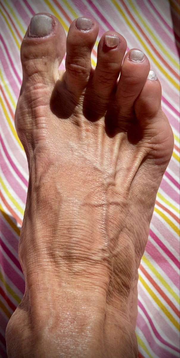 higharchqueenxx's tweet photo. Baby..it’s hot out here!!☀️#veins #feetfetısh #tannedtoes #maturefeet #barefoot https://t.co/B6ao0kaAMz