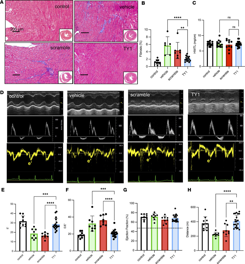 LabWaggoner's tweet photo. Noncoding RNA TY1 reverses fibrosis in systemic sclerosis by attenuating the cGAS/STING pathway @JCI_insight @MarbanLab
https://t.co/BlZxO31Pj4 https://t.co/k1LkH9fBuT