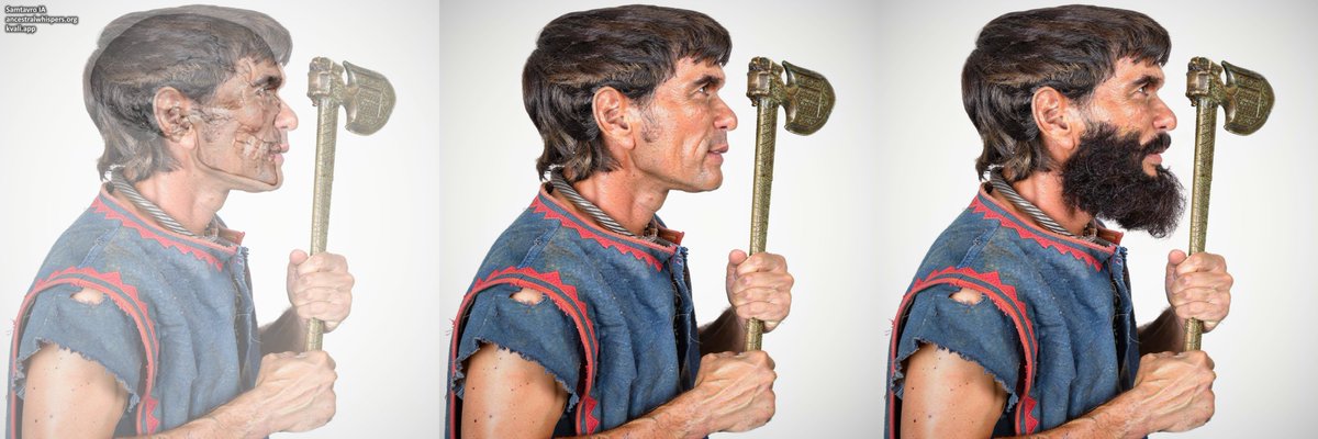 Sulkalmakh's tweet photo. Facial reconstruction of a 2,600-year-old man from Mtskheta, Georgia  

In the Early Iron Age, the area of modern Mtskheta was home to four distinct cultural groups, each characterized by its own weapon arsenal.

1. The Samtavro culture, whose people had been present in the area longer than the other three groups and were characterized by their leaf-shaped daggers. Genetically, they belonged to the Trialeti/Lchashen genetic cluster and were likely Indo-European, possibly Armenic-speaking.
2. The Kakheti culture, whose people were characterized by a wide range of weapons, including daggers, swords, and spears. They originated farther east of Mtskheta and were genetically similar to the previous group, belonging to the Trialeti/Lchashen genetic cluster. They likewise likely spoke an Indo-European language, possibly Armenic.
3. The Koban-Colchian axe wielders, who likely originated to the north, from the Koban metropolis of Liakhvi (Tlia site), which was established in the Late Bronze Age following an expansion of Kobanian tribes, likely from the area of Brili in Racha. Genetically, they were characterized by high CHG ancestry and were likely Kartvelian-Svannic speakers.
4. Another group of Koban-Colchian axe wielders, who also incorporated spears and other weapons into their arsenal. Their genetic profile was similar to that of the aforementioned Kobanians, but with less CHG. They were likely Kartvelian-Georgian speakers originating from the Samtskhe and Borjomi areas, from sites such as Atskuri and Chitakhevi, and were expanding into other regions of modern Georgia.

As time progressed deeper into the Iron Age, the contest for control of the Mtskheta area have been won by the last, Georgian group, as a few centuries later, during Antiquity, the historical record of the Iberians (East Georgians) begins with Mtskheta as their capital.

The reconstructed individual belongs to a period characterized by Kartvelian dominance in the area, and was described by the anthropologist Malkhaz Abdushelishvili (1952) as follows:  

Grave burial No. 309. Northern section. 1948 (Kalandadze). 
Male skull, although fragmented, has been restored quite well. In superior view, it is very long and pentagonal in shape. In the sagittal plane, the following features are noted: strongly developed brow ridges, a sloping forehead, a rounded and gradually descending vertex toward the occiput, and a rounded, slightly projecting occiput. The face is medium-high and apparently broad, with slight alveolar prognathism. The relief is rather strongly expressed. The skull is large and massive.  

He had a large cranial length of 197 mm, a medium cranial width of 141 mm, a medium-large mandibular width of 102 mm, and a cranial capacity of 1,520 cm³.