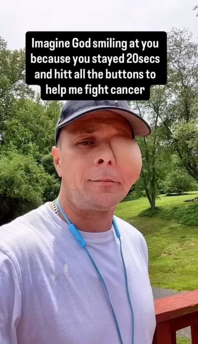 AlexanderR976's tweet photo. 💔 Being diagnosed with eye cancer changed my life in an instant. The journey has been painful and uncertain, filled with challenges I never thought I would face.

But through it all, I’m still fighting, still hoping, and refusing to give up. 🙏❤️
https://t.co/IMFGNDajwv https://t.co/VFAuBRd7dU