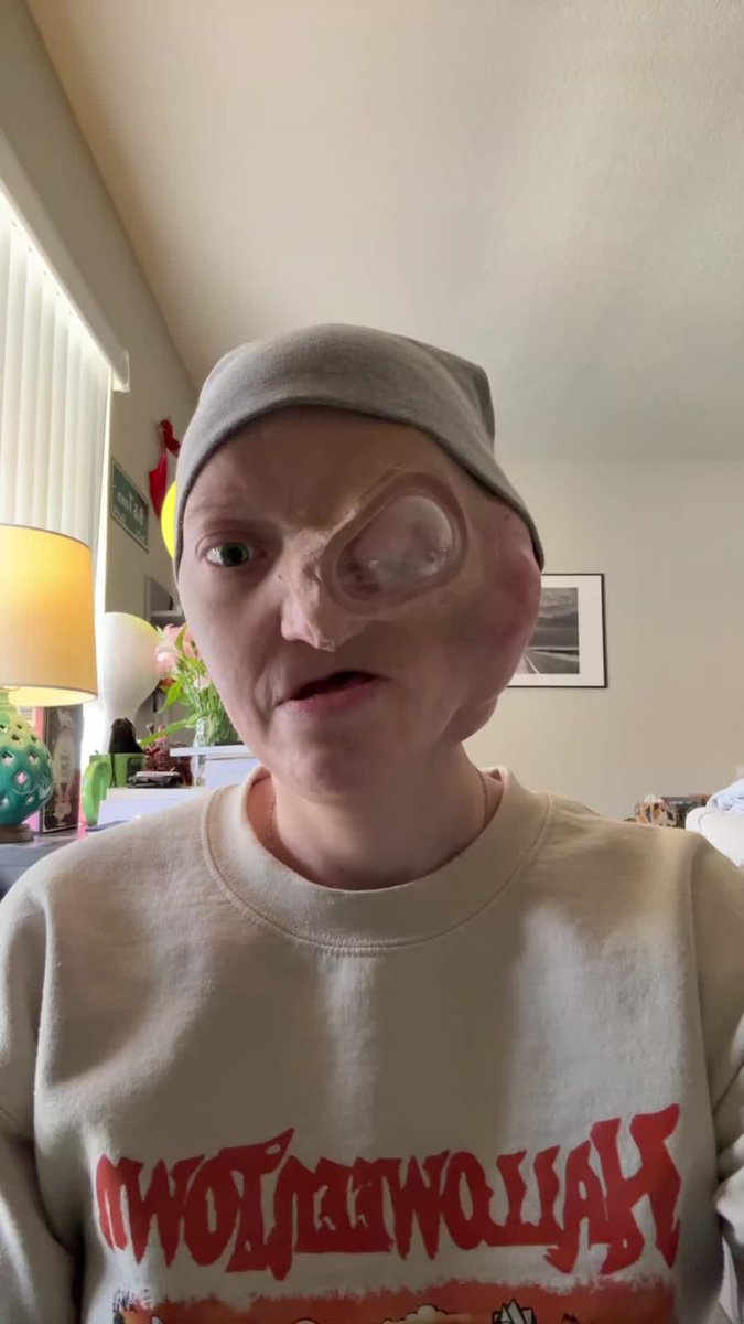 Natalie9c's tweet photo. My life changed completely when I was diagnosed with face cancer. The treatment has been incredibly difficult, and the medical costs are more than I can afford. 🙏

I’m doing my best to stay strong and keep fighting every day. Please donate

https://t.co/r6SsLimyWl https://t.co/yQHN2R48O2